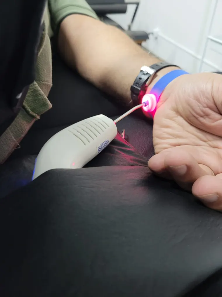 Aparelho de laser ILIB apoiado no antebraço do paciente durante a sessão