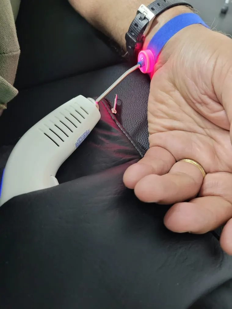 Aplicação da terapia ILIB: o clipe do laser preso ao punho do paciente e a caneta do aparelho na mão do fisioterapeuta